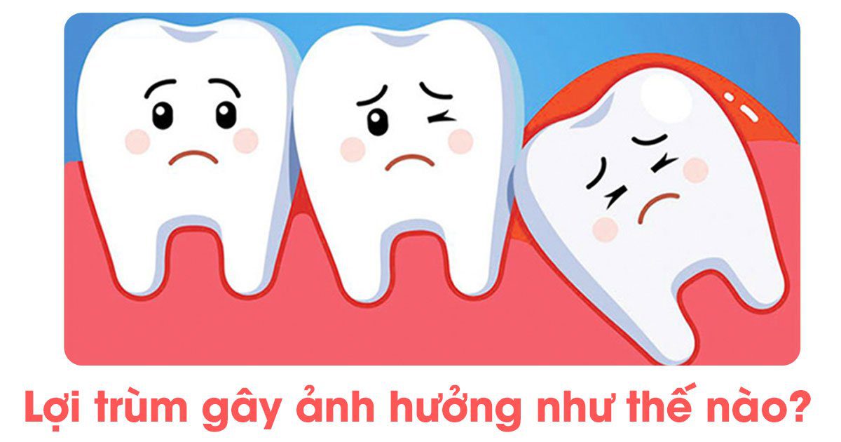 Lợi trùm gây ảnh hưởng như thế nào?