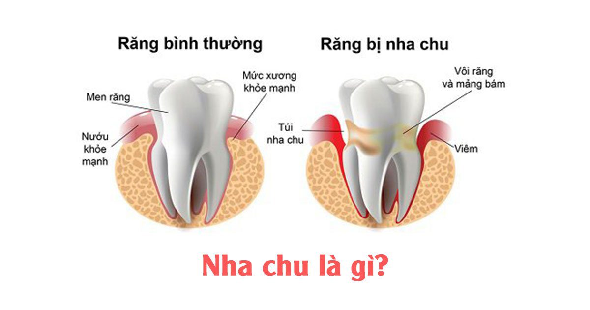 Nha chu là gì?