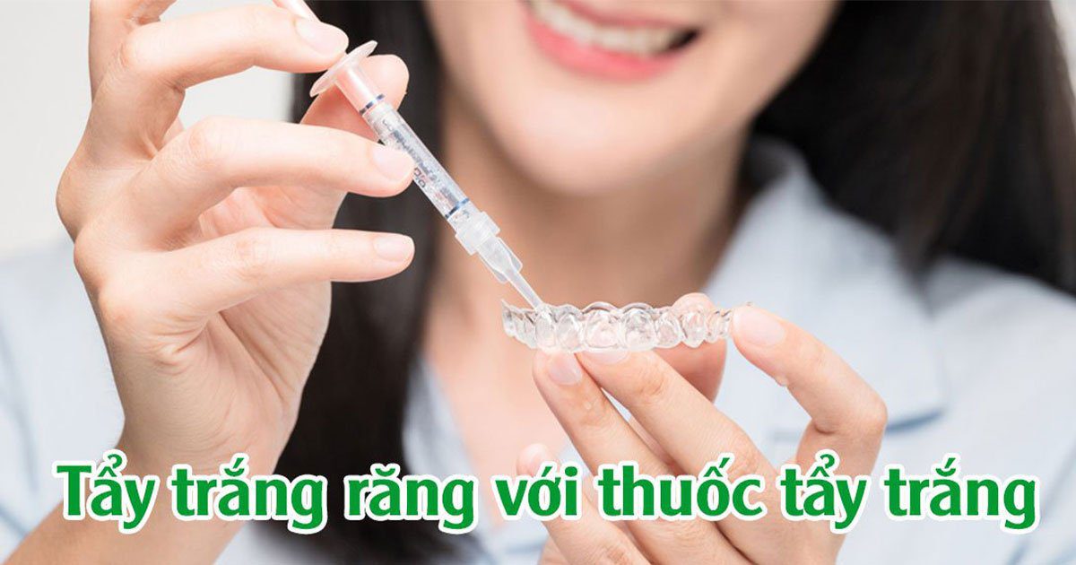 Tẩy trắng răng với thuốc tẩy trắng