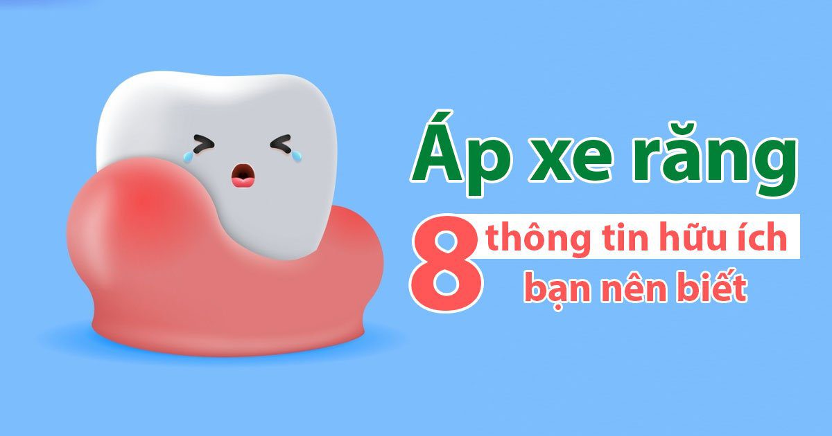 Áp xe răng - 8 thông tin hữu ích bạn nên biết