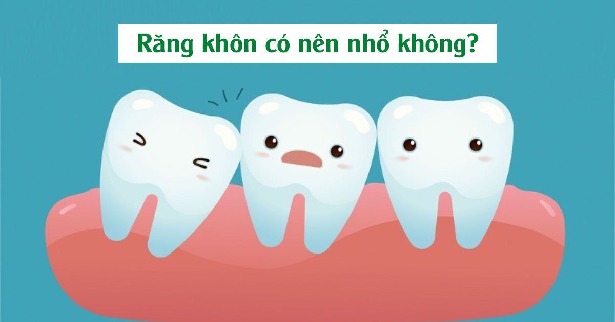 Răng khôn có nên nhổ không?