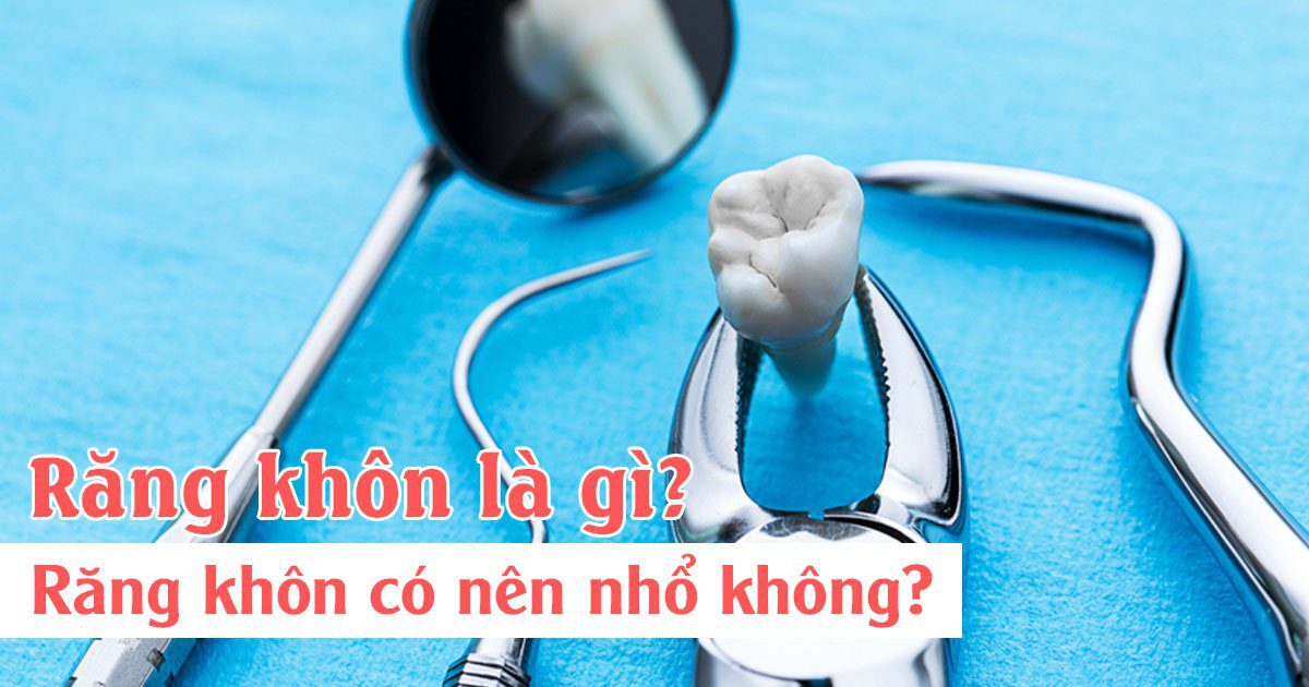 Răng khôn là gì? Răng khôn có nên nhổ không?