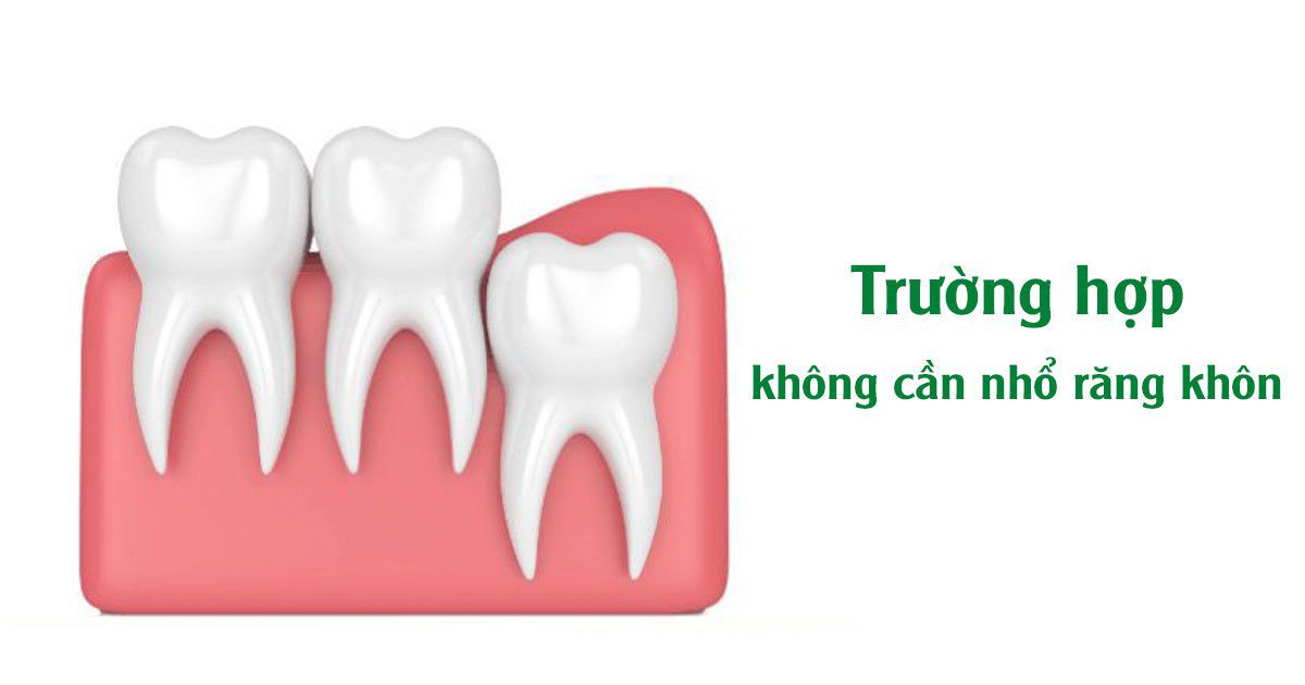 Trường hợp không cần nhổ răng 8