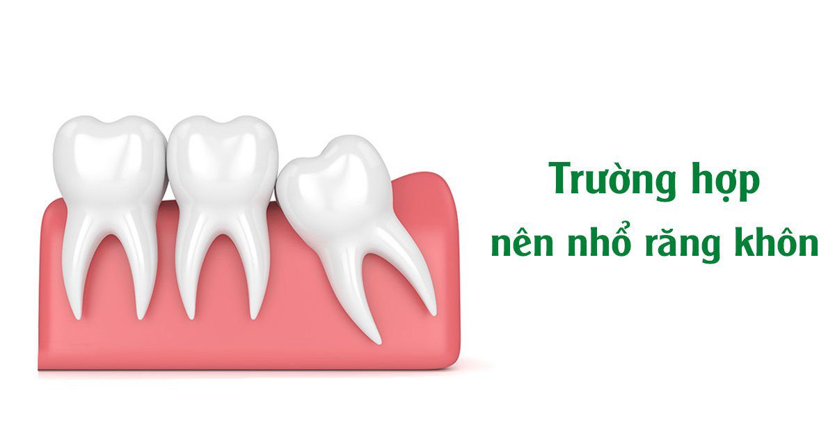 Trường hợp nên nhổ răng khôn