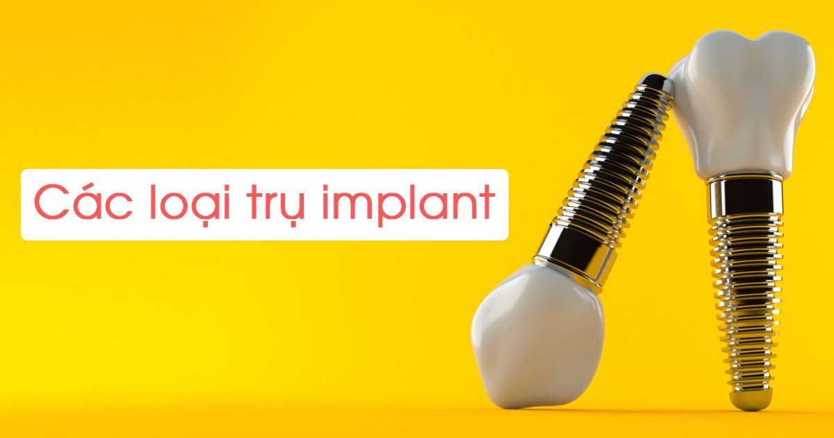 Các loại trụ implant