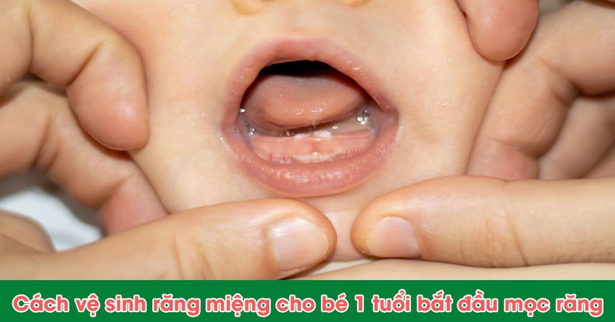 Cách vệ sinh răng miệng cho bé 1 tuổi bắt đầu mọc răng
