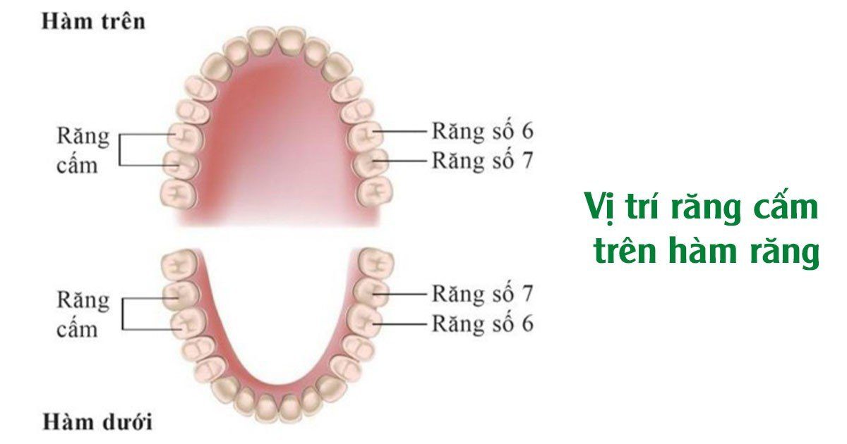 Răng cấm là răng số 6, răng số 7