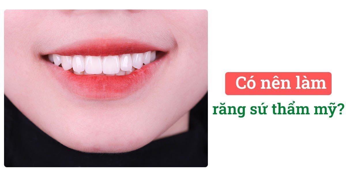 Làm răng sứ thẩm mỹ là gì?