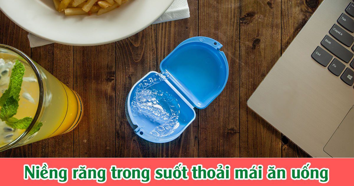 Khay niềng răng trong suốt