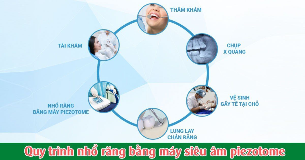 Quy trình nhổ răng bằng máy siêu âm piezotome