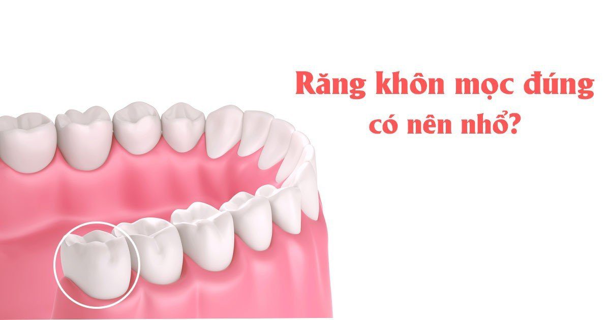 Răng khôn mọc đúng có nên nhổ?