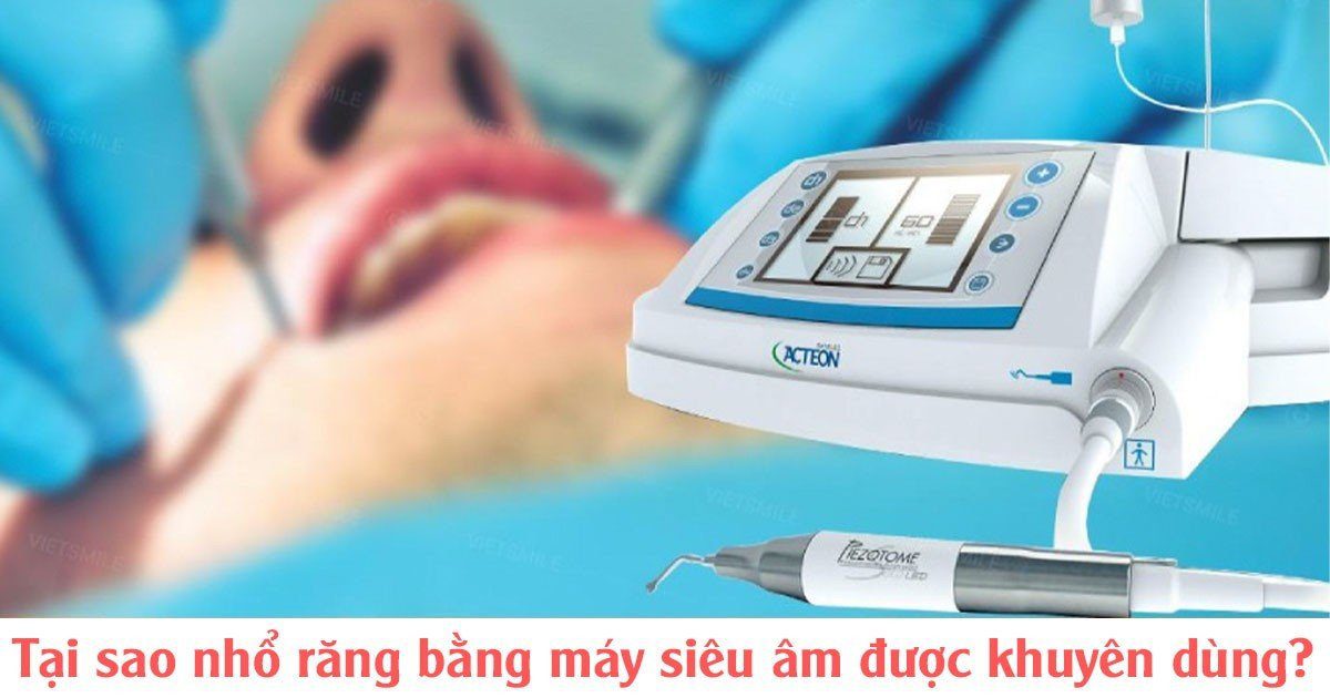 Tại sao nhổ răng bằng máy siêu âm được khuyên dùng?