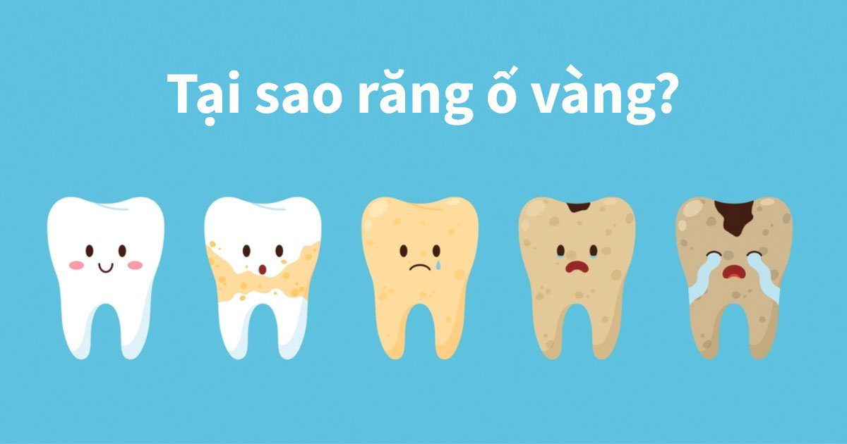 Tại sao răng ố vàng?