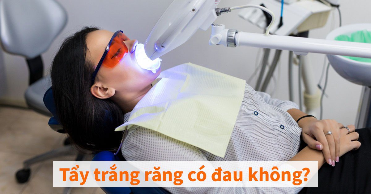 Tẩy trắng răng có đau không?