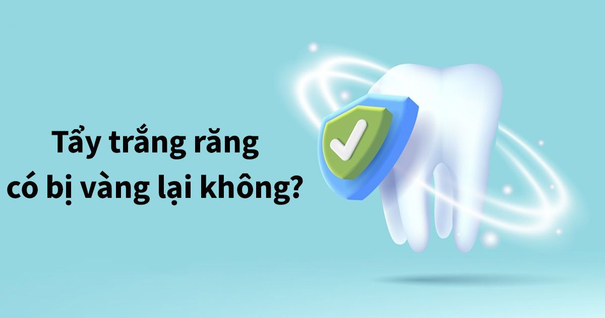 Tẩy trắng răng có bị vàng lại không?