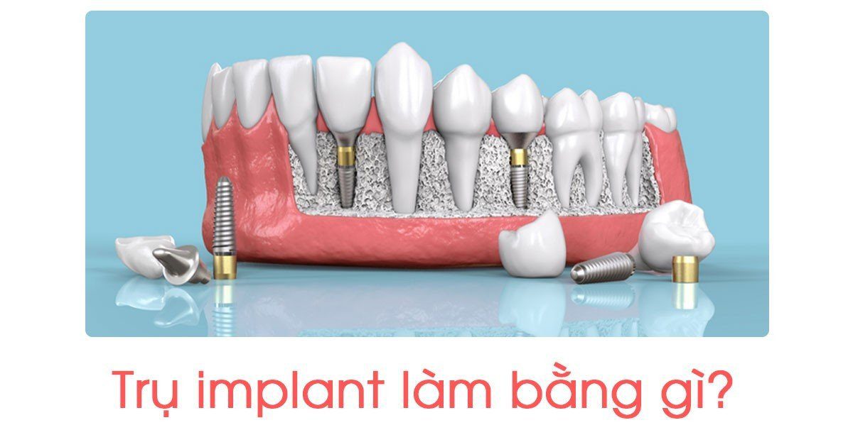 Trụ implant làm bằng gì?
