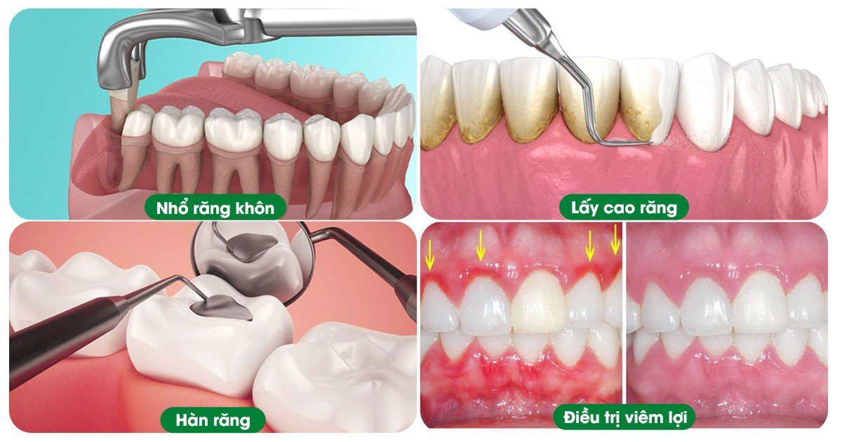 Các dịch vụ tại nha khoa tâm đức